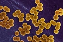 Persistent Nasal Staph Colonization Linked to Broader Microbiome Features