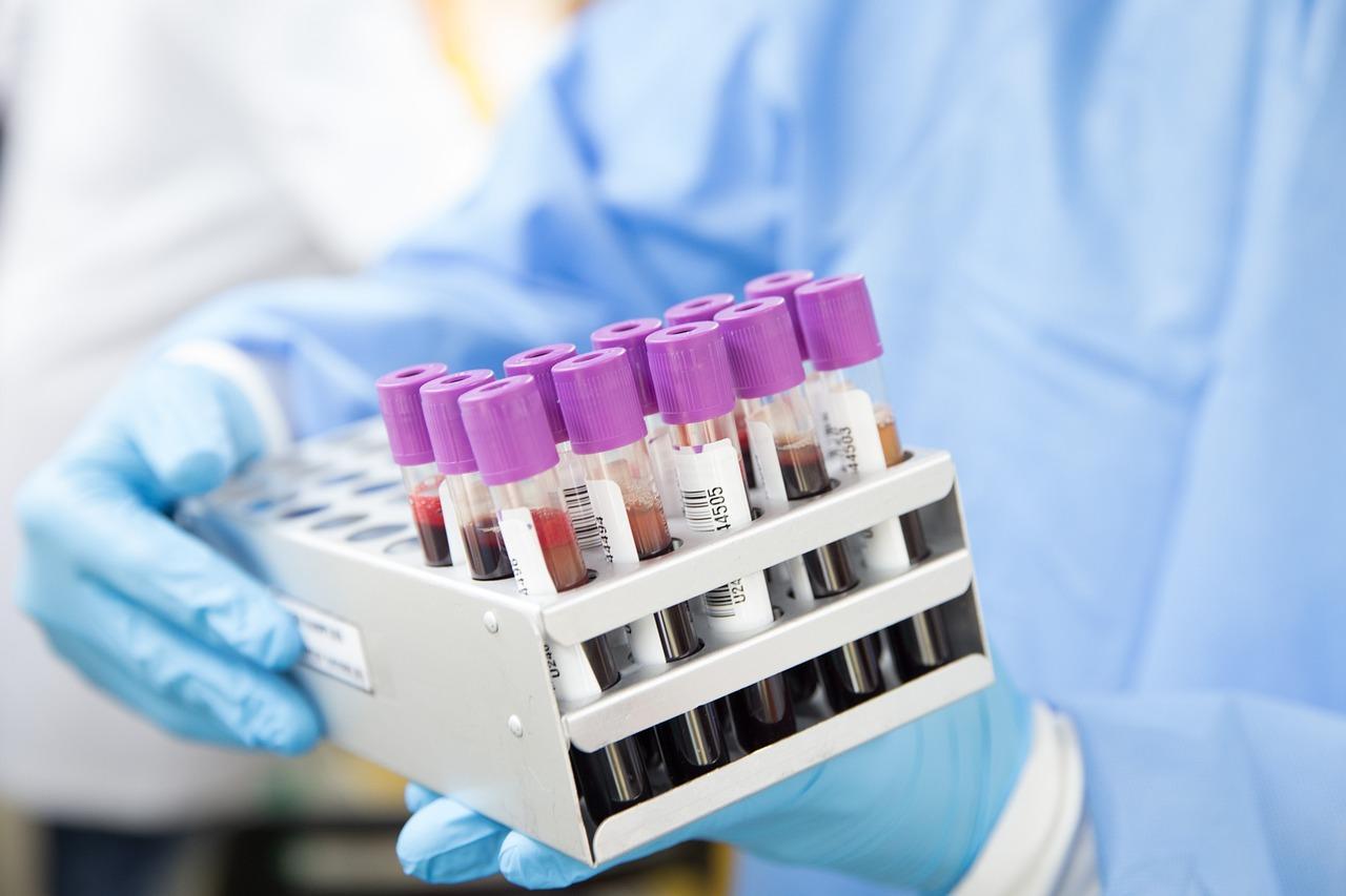 In Vitro Diagnostic Industry in China - Blood Typing Instruments and Reagents XVI